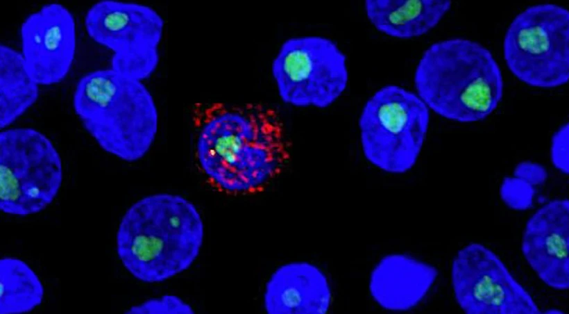 Xuất hiện một loại thuốc có thể ngăn ngừa nhiễm HIV trong một năm